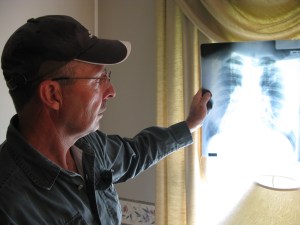 Retired coal miner Mark McCowan reviews an X-ray of his diseased lungs at his home in Pounding Mill, Virginia.