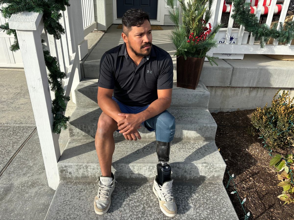 Workplace Amputations Are on the Rise