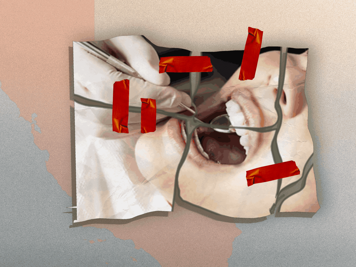 California Delayed Medi-Cal Dental Cuts for Immigrants, But Worry and Confusion Persist